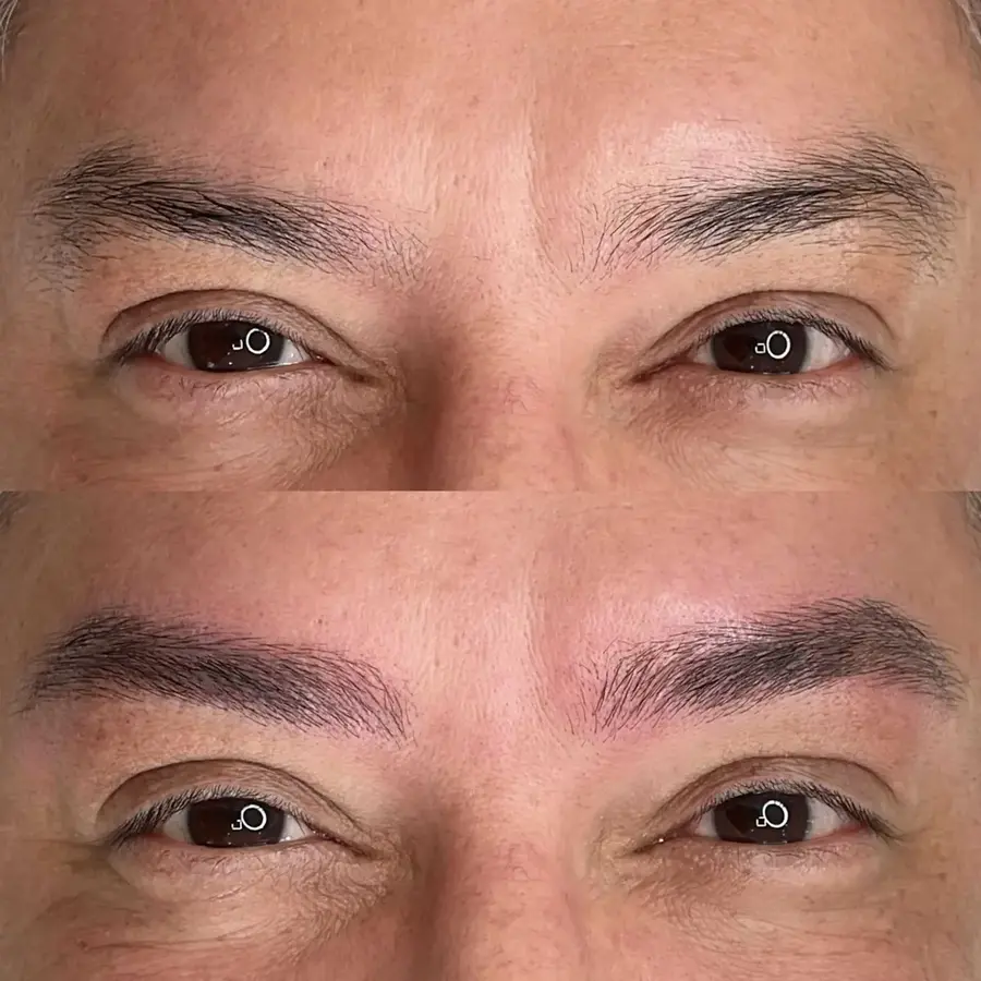 4D Erkek Kaş Tasarımı sonrası – uzun süreli sonuç